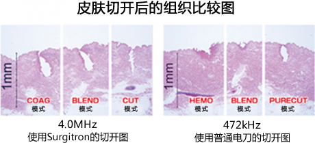 皮肤切开后的组织比较图